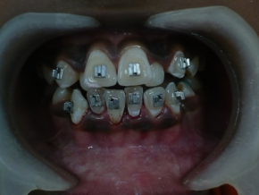 Orthodontics